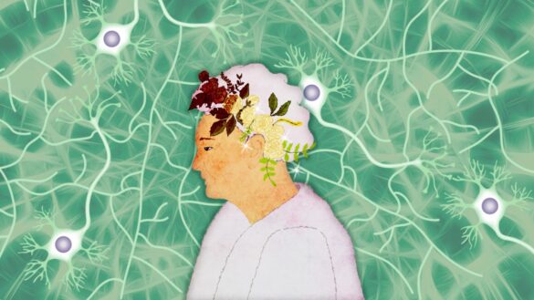 How are we protecting our brains from Alzheimer’s?